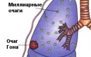 Журнал пульмонология и туберкулез