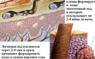 Чесотка на руках и ногах